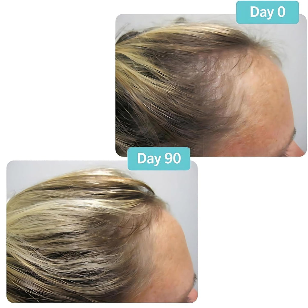Hair Growth Supplement 180 Tablets Y634