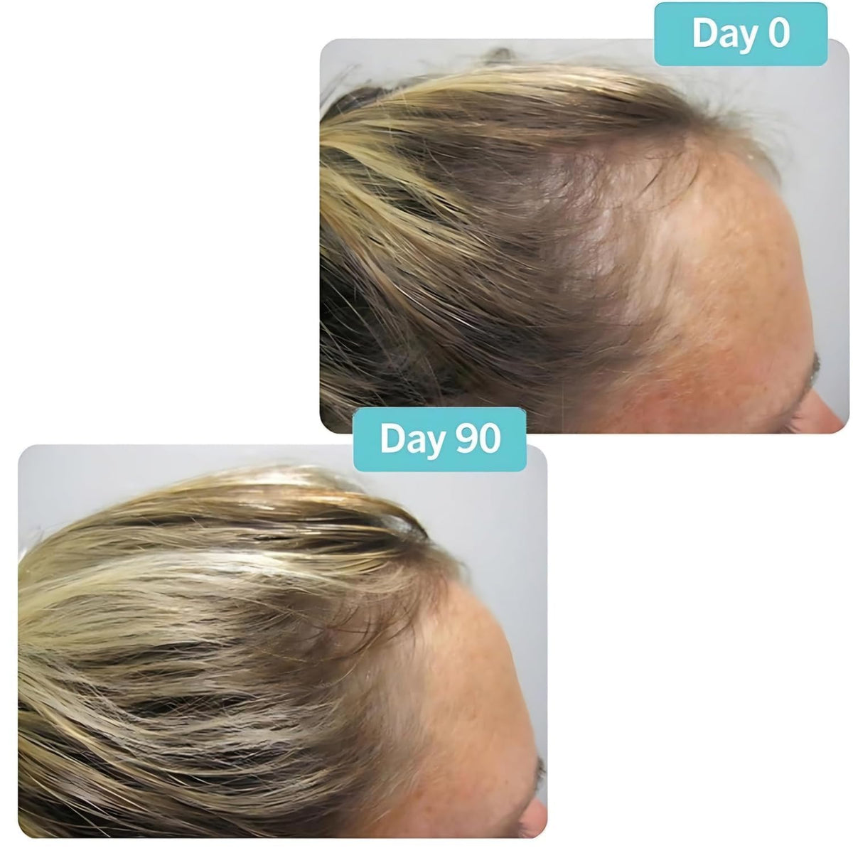 Hair Growth Supplement 180 Tablets Y634